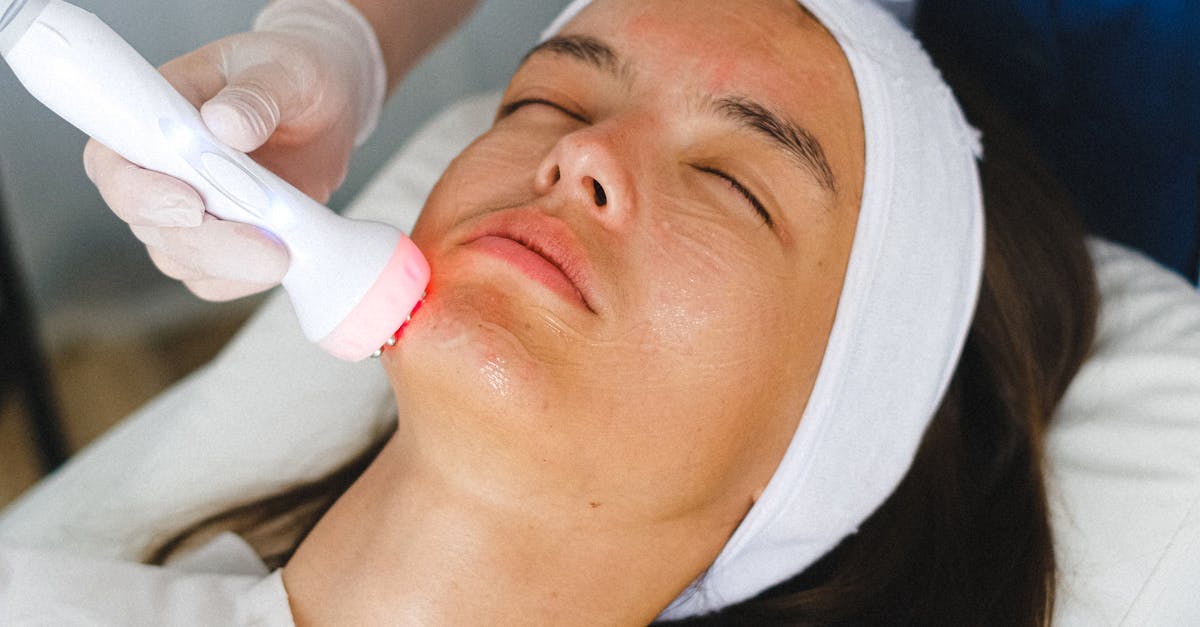 Benefits of Chemical Peels for Skin Rejuvenation